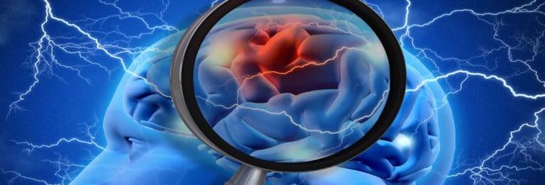 Philadelphia brain injury Lawyers Injury Lawyer